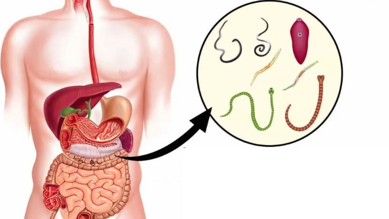 Tipos de parasitos no corpo